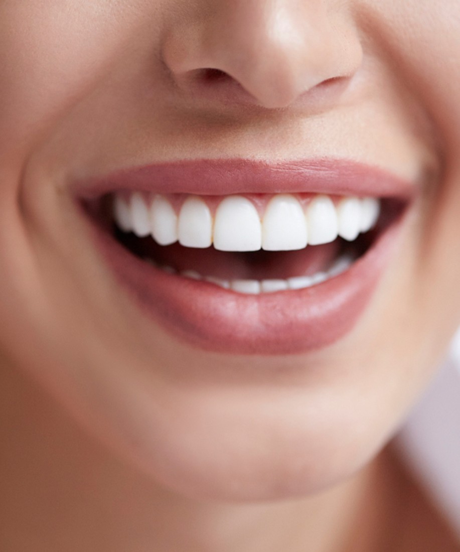 Teeth Whitening In Homewood, AL by Central Avenue Dentistry